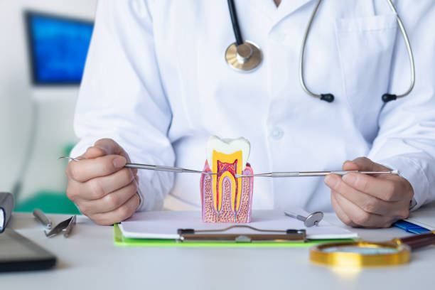 Best Knocked-Out Tooth (Avulsed Tooth) Treatment in Resaca, GA