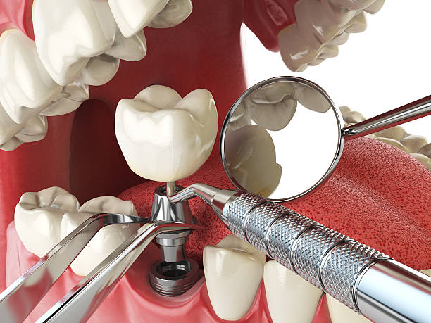 Best Emergency Treatment for Jaw Pain or Injury in Resaca, GA